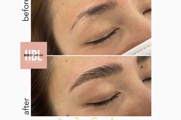 小山市ハリウッドブロウリフト