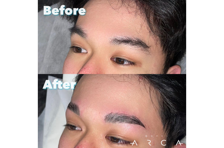 小山市ハリウッドブロウリフト