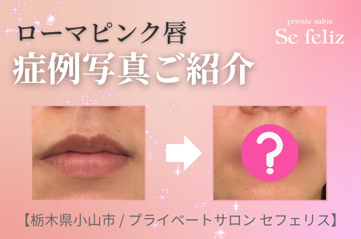 ローマピンク唇