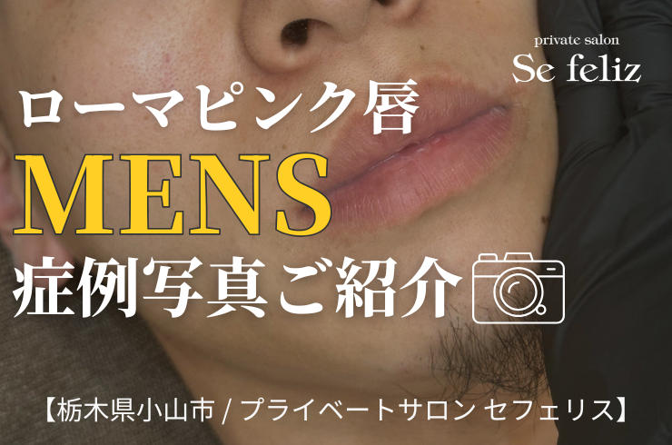 ローマピンク男