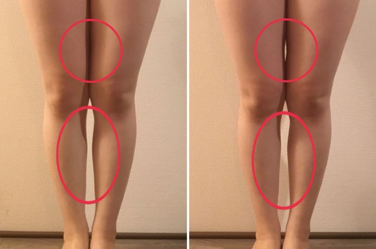 栃木県小山市で痩身エステがあるエステサロン