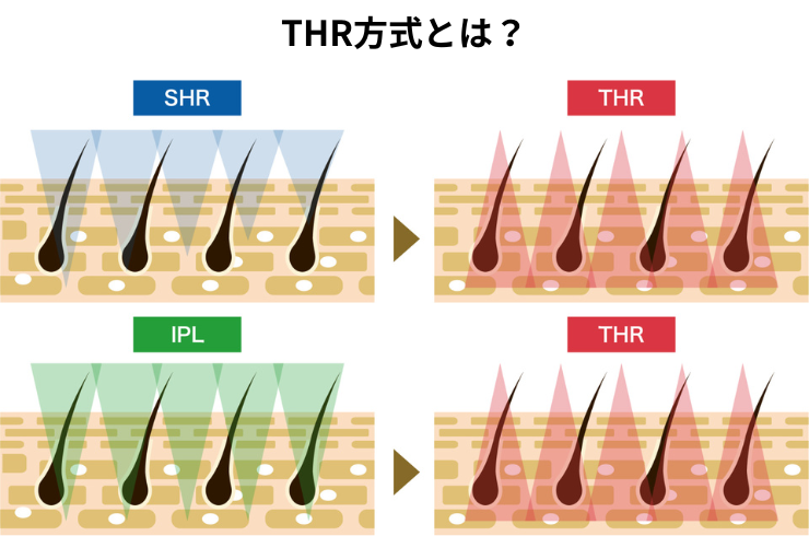 THR