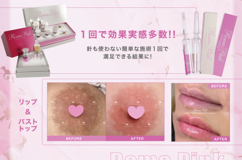 新品　ローマピンク　リップ用　アフターケアクリーム 話題の“ローマピンク”って知ってますか？憧れの赤ちゃんピンクへ